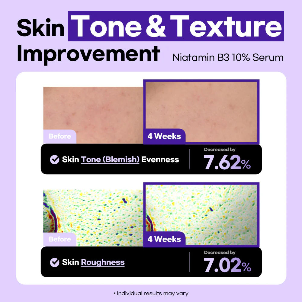 Lesimo Niatamin B3 10 % Serum, Gesichtsserum für Glashaut / Vitamin B3, Niacinamid für dunkle Flecken, geeignet für empfindliche Haut / vegan und tierversuchsfrei, 50 ml