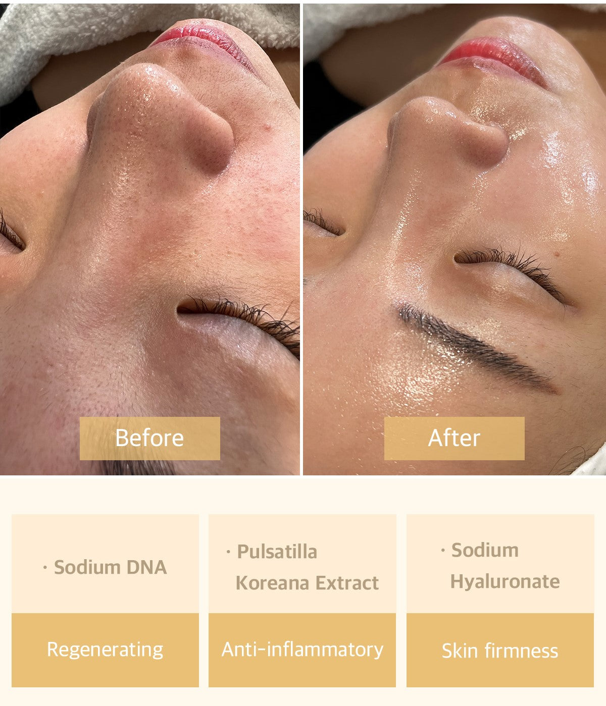 Microneedling Anti-Aging + Aufhelendes program Lachs-DNA Gold + Dermawhite