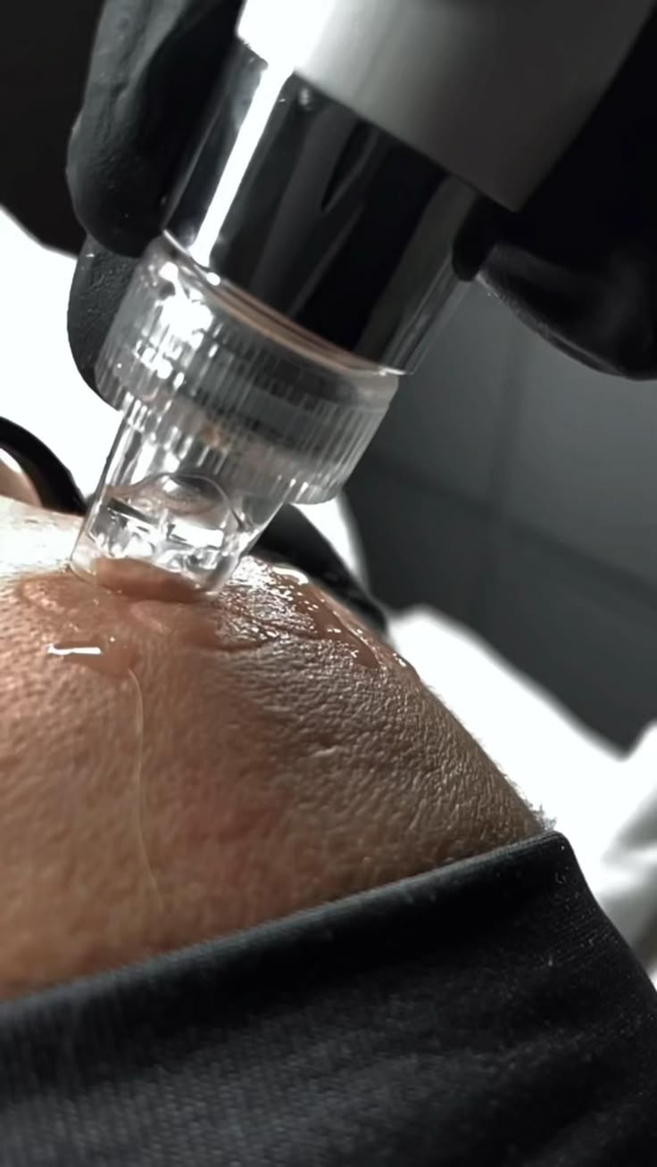 HydraFacial behandlung