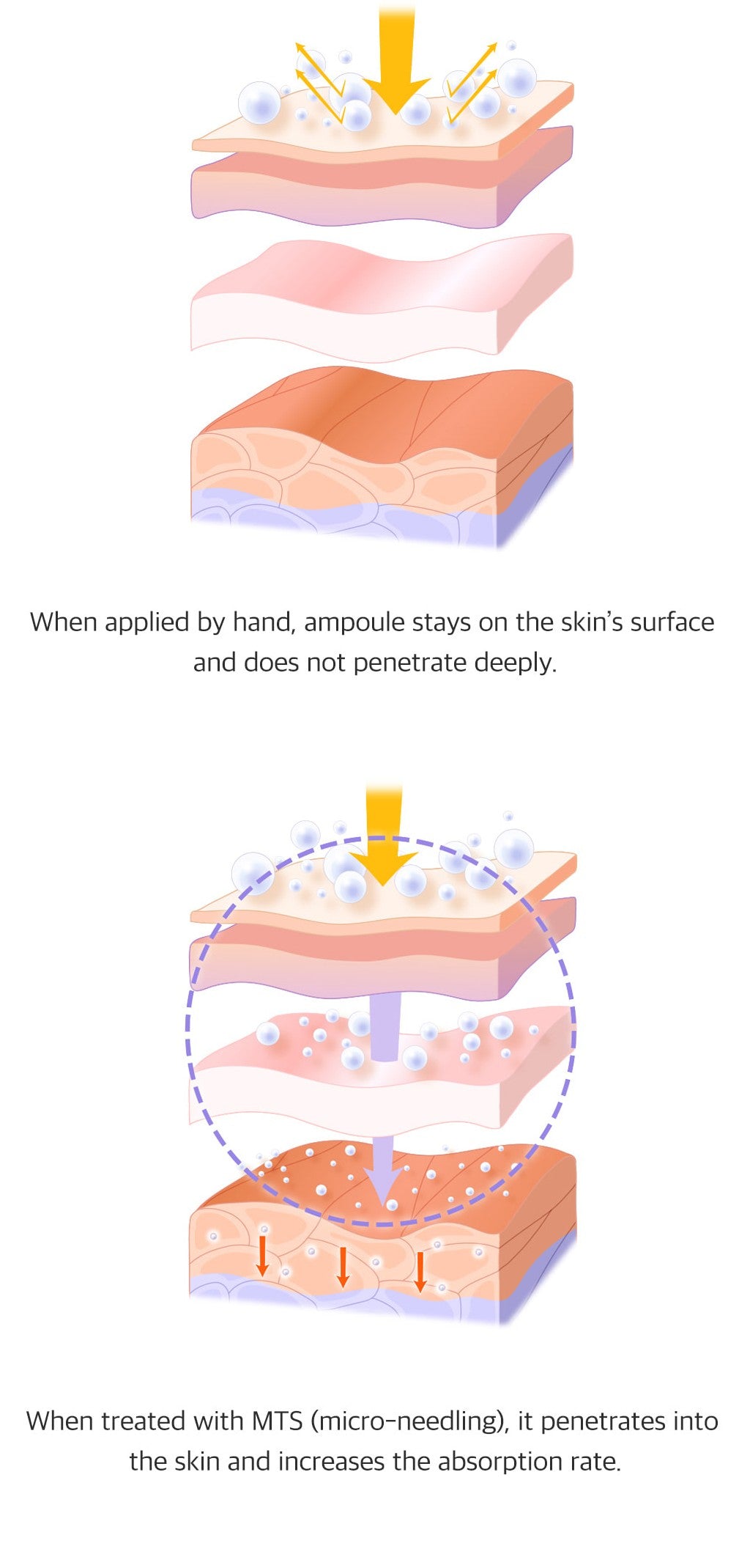 Microneedling Hautelastizität mit Idebenone- Früchte extrakt