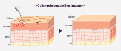 Mesotherapie Haut Elasticität Collagen Booster