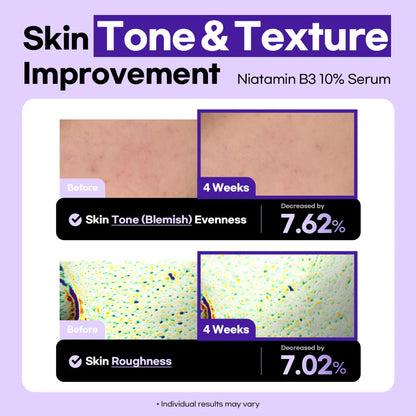 Lesimo Niatamin B3 10 % Serum, Gesichtsserum für Glashaut / Vitamin B3, Niacinamid für dunkle Flecken, geeignet für empfindliche Haut / vegan und tierversuchsfrei, 50 ml