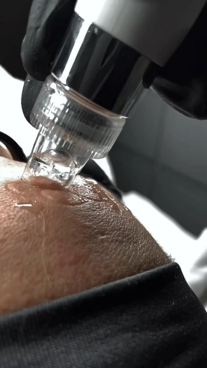 HydraFacial behandlung