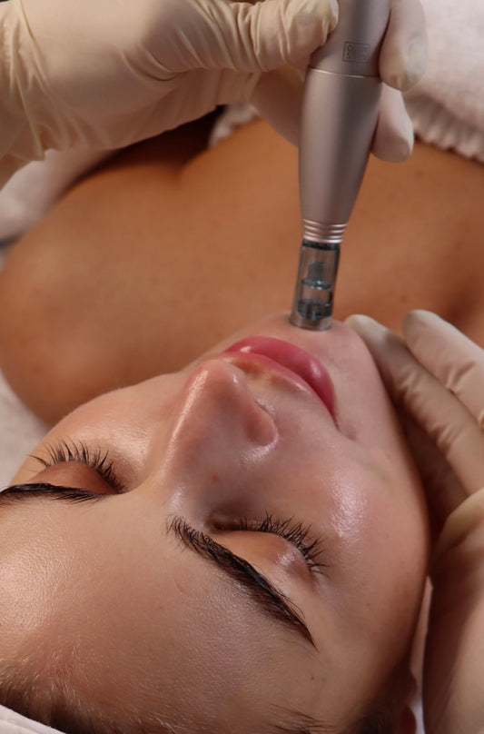 Microneedling Exosom + Plant Green