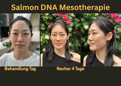 Mesotherapie Anti -Aging + Lifting Lachs-DNA Skinbooster