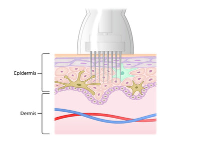Microneedling Microbiome+Gold