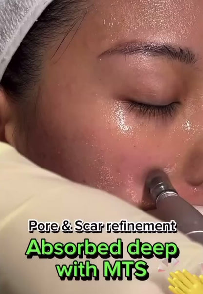 Microneedling Anti-Aging + Aufhelendes program Lachs-DNA Gold + Dermawhite